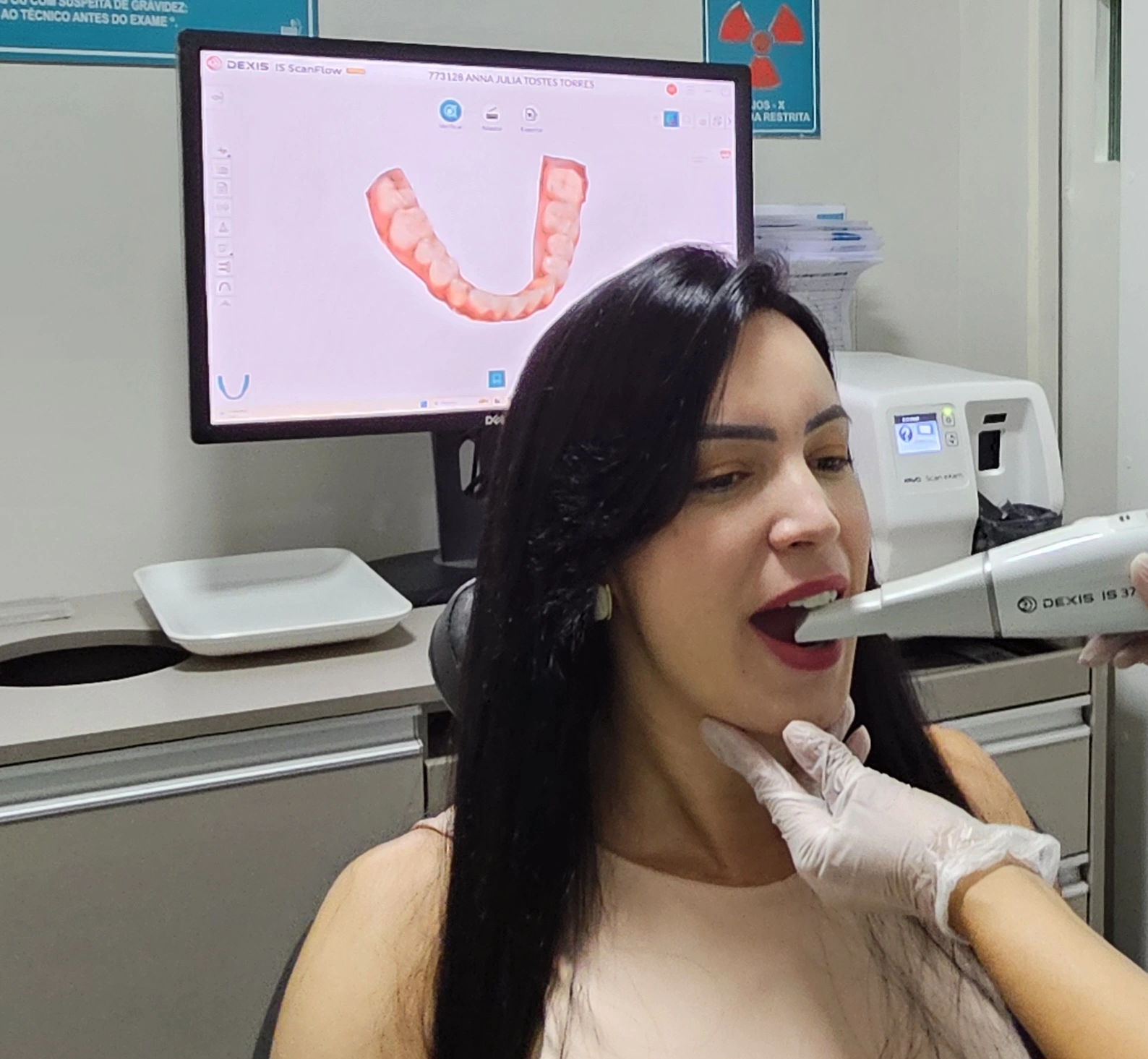 Escaneamento-intraoral