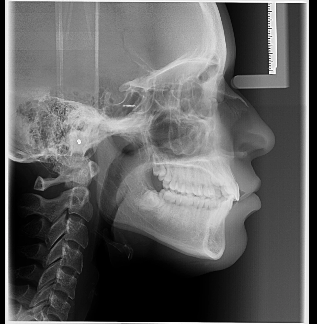 img-telerradiografia